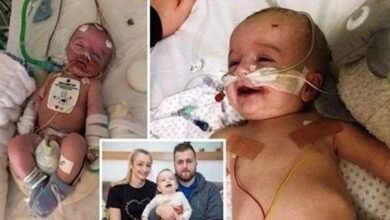 Após 5 dias em coma, bebê acorda sorrindo para o pai
