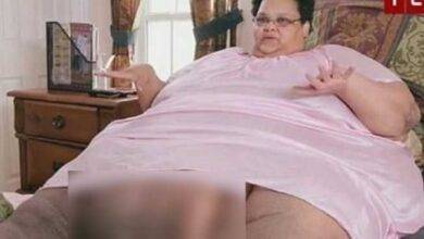 Ela perdeu mais de 340kg para sobreviver e precisou reaprender a andar; está irreconhecível hoje