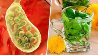 Como eliminar pedras da vesícula naturalmente