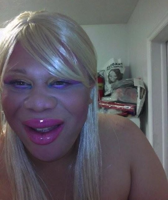 botox-2
