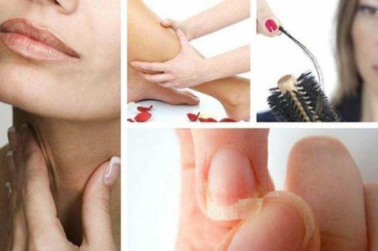 8 sinais de alerta preocupantes do hipotireoidismo 1s