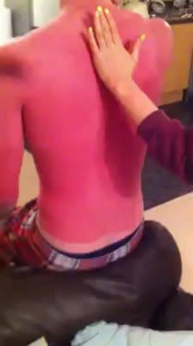 3-18-pessoas-que-esqueceram-o-quanto-as-marcas-de-sol-podem-ser-constrangedoras-as-vezes