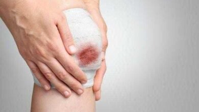 3 plantas para curar e cicatrizar feridas