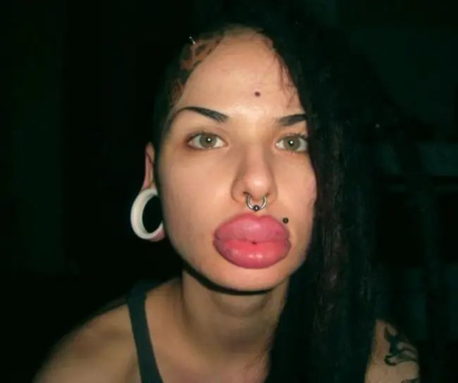 22 Mulheres que queriam ficar mais bonitas…mas deu MUITO errado