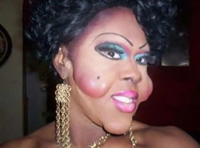 22 Mulheres que queriam ficar mais bonitas…mas deu MUITO errado