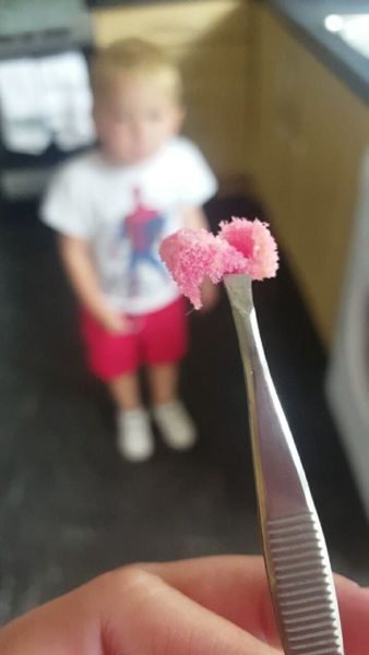 1750657933 424 mae fica chocada ao descobrir o que causava mau halito