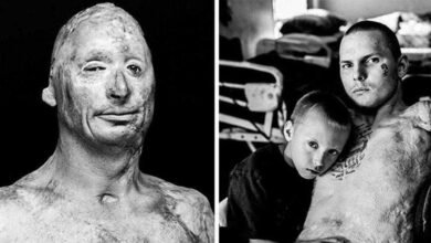Fotos chocantes mostra como vivem os veteranos depois das guerras