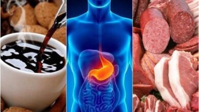 8 alimentos que podem causar refluxo ácido