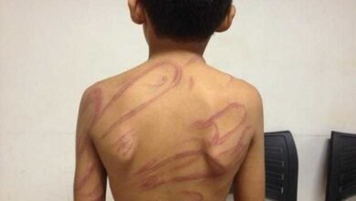 Mãe é presa após surra filho de 7 anos com chibatadas de cipó