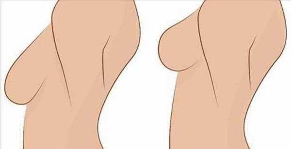 3 Truques para acabar com os seus seios flácidos