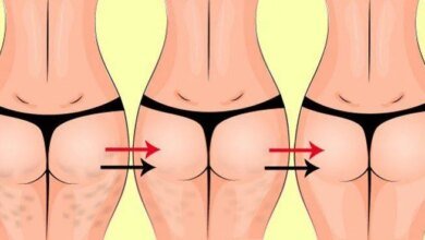 4 exercícios para acabar com a celulite