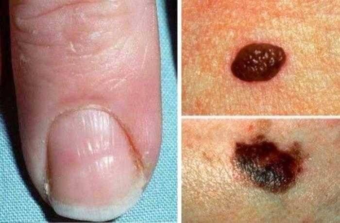 4 Sinais urgentes que o nosso corpo envia para indicar que algo não está bem!