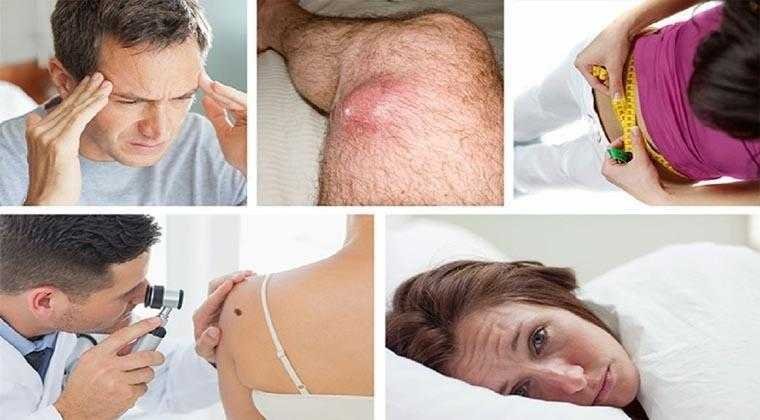 5 Sintomas de câncer que varias pessoas ignoram