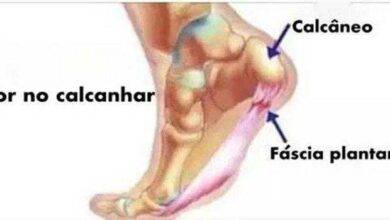 5 formas de tratar a dor no calcanhar naturalmente e eliminá-la para sempre!