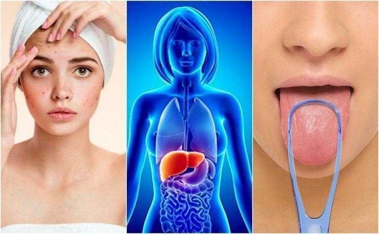 7 Sinais do corpo de um fígado sobrecarregado 1