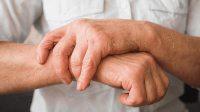 8 sinais de artrite reumatoide