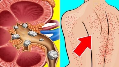 8 Sinais de que os rins não estão funcionando bem que muita gente desconhece