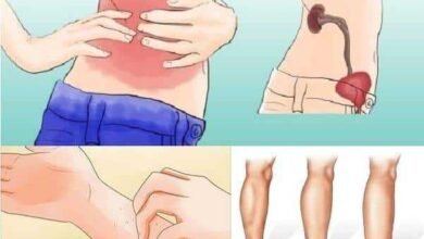 9 Sinais que seus Rins Pedem Socorro