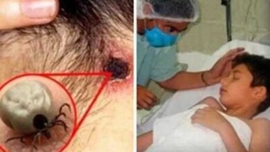 (ALERTA) Se você tem o hábito de colocar seu cão/gato no sofá e cama, sua saúde está em perigo. Saiba por quê.