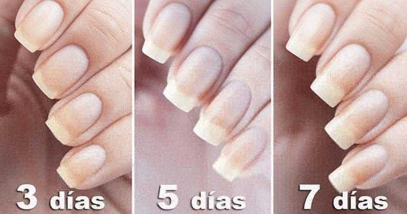 Aprenda a usar bicarbonato para ter unhas mais longas e fortes