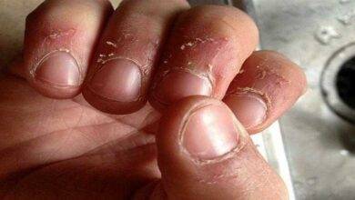 Como prevenir e curar cutículas naturalmente