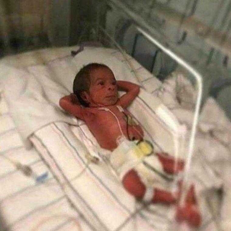 Ele nasceu há poucas horas, mas a foto já deu a volta ao mundo d