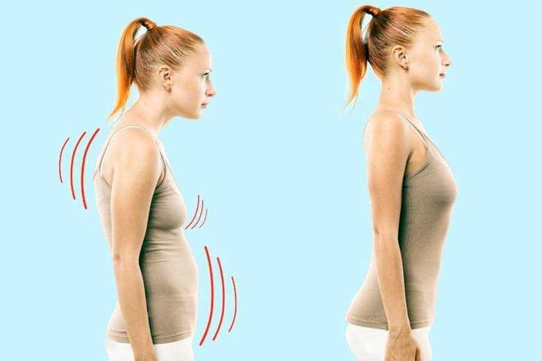 Exercícios para Melhorar a Postura