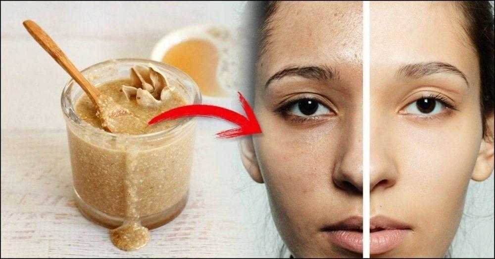Rejuvenescer a Pele