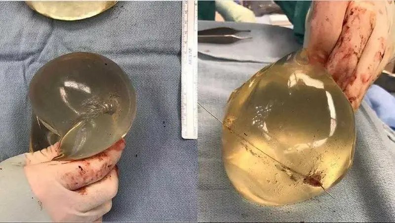 silicone