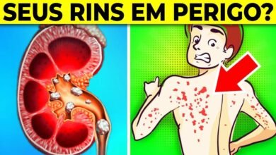 Se seus rins estiverem doentes, estes 21 sinais vão aparecer no seu corpo