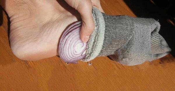 Tratamento com cebola para eliminar calos