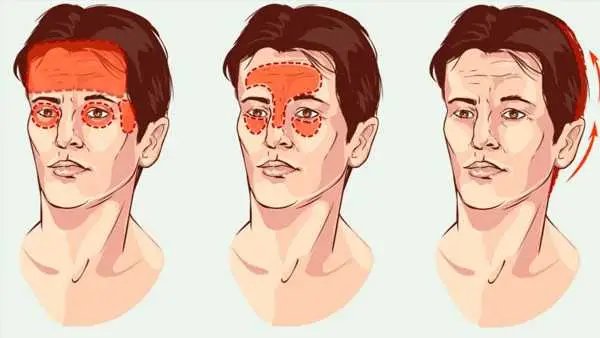 Como diferenciar uma enxaqueca de uma dor de cabeça emocional