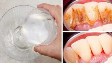Elimine a placa bacteriana-tártaro e ainda clareia os dentes 1