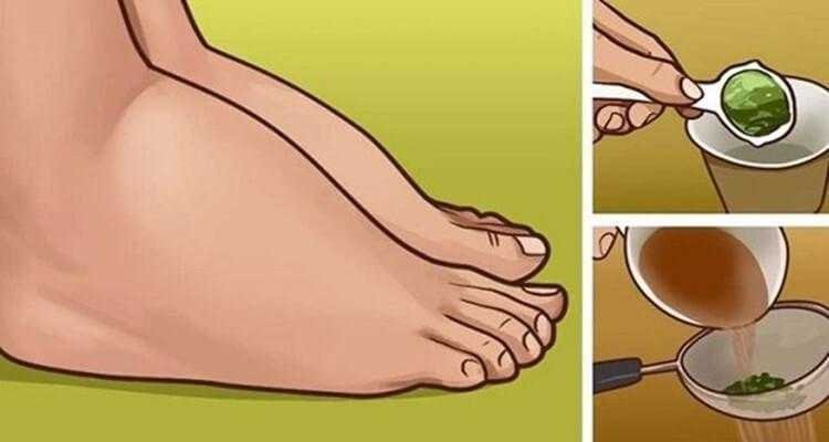 Excelente remédio caseiro para pernas inchadas 2