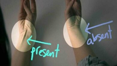 VOCÊ TEM OU NÃO ISTO NO BRAÇO? O SIGNIFICADO É MAIS INCRÍVEL DO QUE VOCÊ IMAGINA