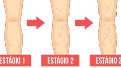 14 sinais que indicam que seu corpo está com má circulação de sangue