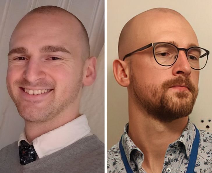 1631587794 820 18 Fotos que mostram que a barba pode transformar a