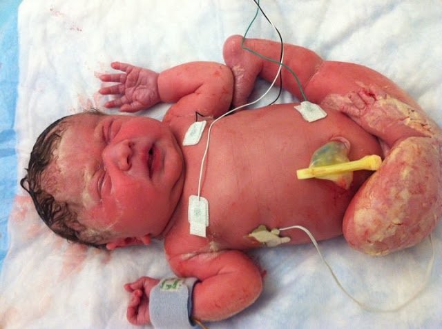 1493313312 40 medicos apertam a barriga da mae e quebram o bebe inteiro momentos depois eles descobrem o improvavel