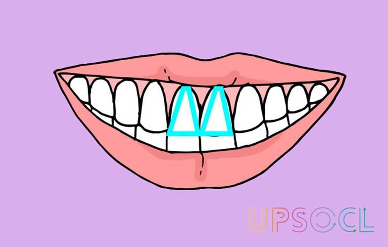 formato_dentes_4