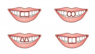O formato dos dentes da frente revela muito sobre a sua personalidade