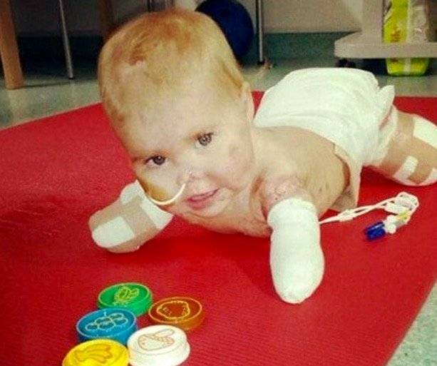1497277426 876 ao completar 11 meses essa garotinha comecou a apodrecer viva voce precisa ver o motivo