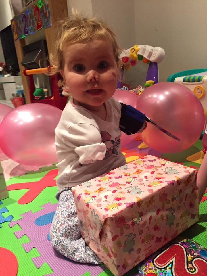 1497277427 493 ao completar 11 meses essa garotinha comecou a apodrecer viva voce precisa ver o motivo