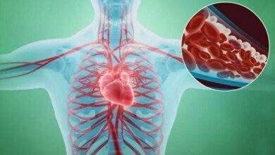 9 Sinais de que suas artérias estão entupidas