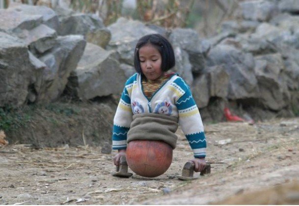 1499962210 437 se voce acha que sua vida e miseravel veja esta historia inspiradora sobre a garota basquete