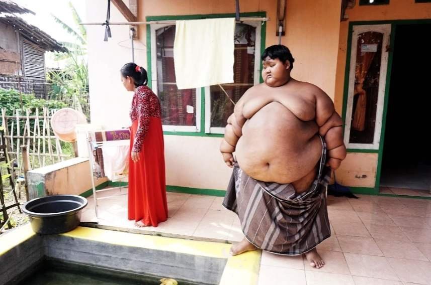 1614045238 528 Menino mais gordo do mundo que pesava 190 quilos passa