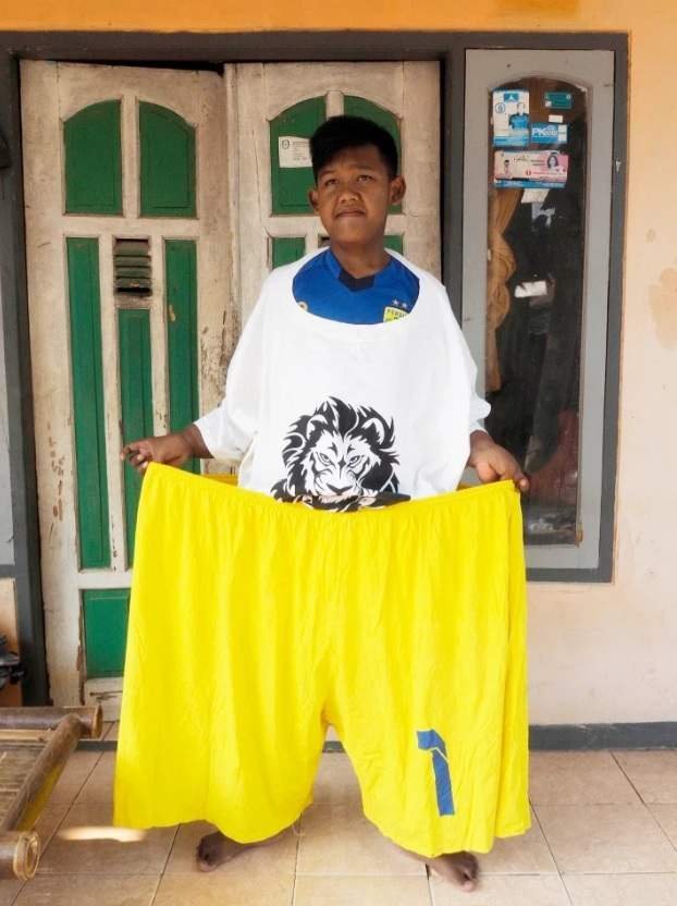 1614045239 791 Menino mais gordo do mundo que pesava 190 quilos passa