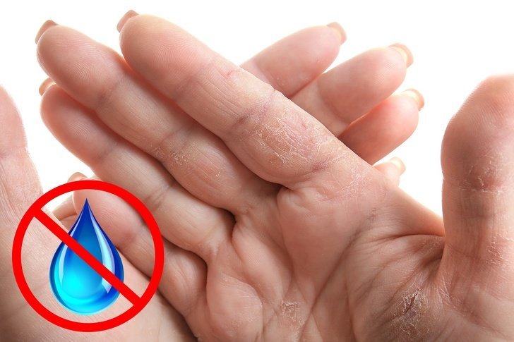 7Coisas que asmãos podem revelar sobre sua saúde
