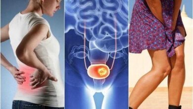 7 sinais de câncer de bexiga aos quais devemos ficar atentos 1q