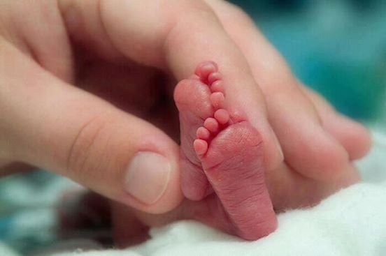 1493727082 640 este bebe pesa apenas 230g mas depois de nascido sua mae encontra isso em seu berco
