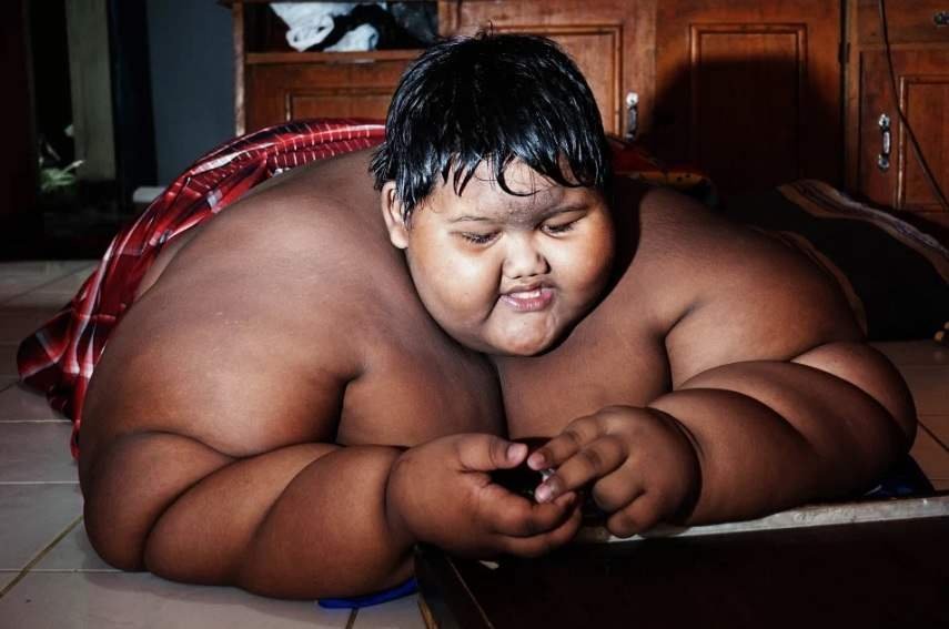 Menino mais gordo do mundo que pesava 190 quilos passa
